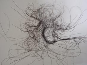 掉头发是什么原因造成的呢?